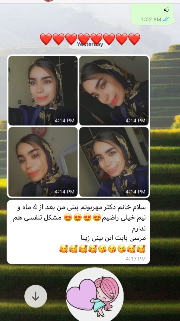رضایت مراجعین از عمل بینی توسط دکتر ضیغمی
