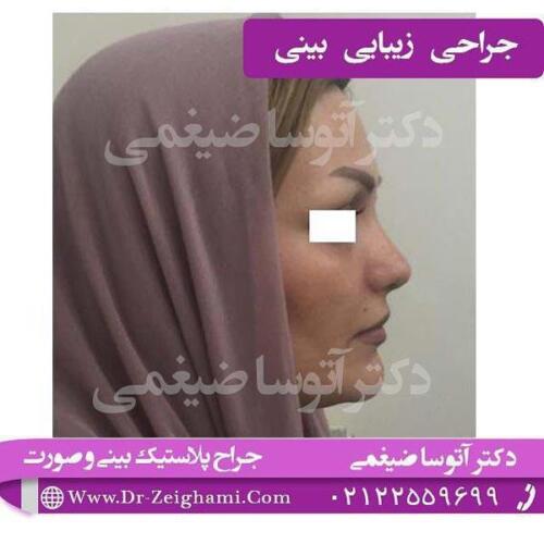 عمل-بینی-136