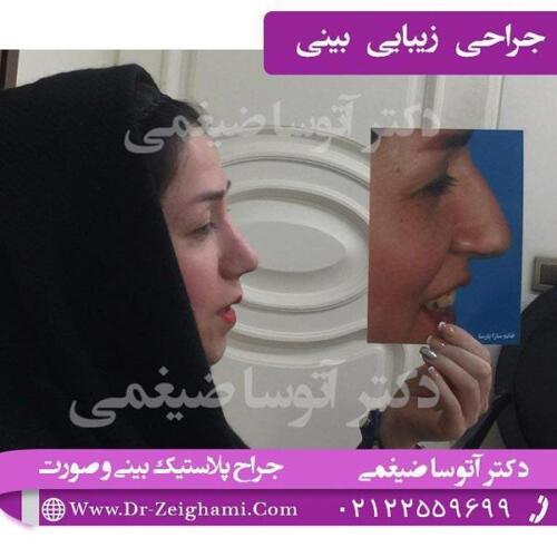 عمل-بینی-142