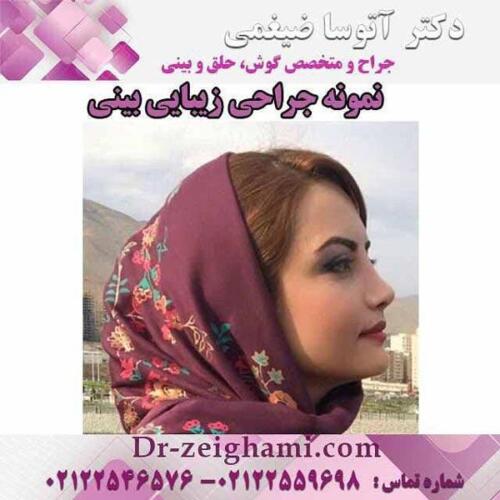 عمل-بینی-144