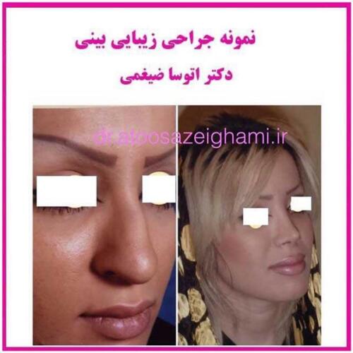 عمل-بینی-145