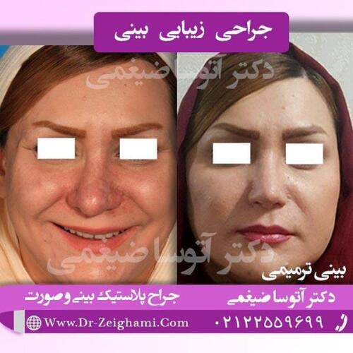 عمل-بینی-146