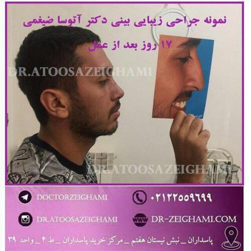 عمل-بینی-147