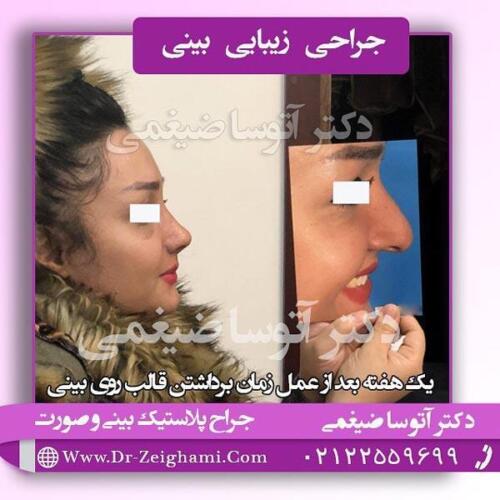 عمل-بینی-148