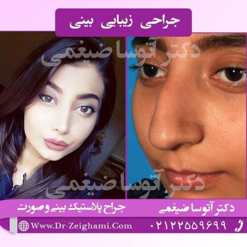 عمل-بینی-149