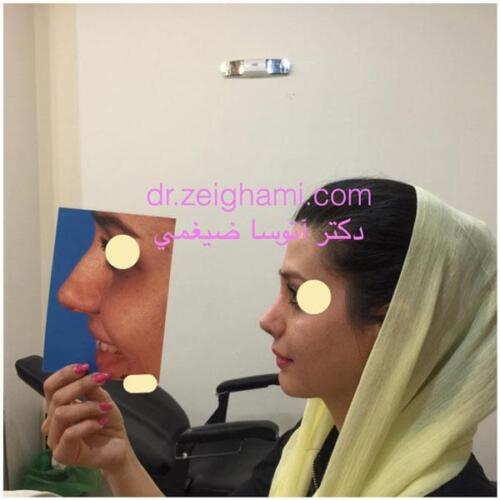 عمل-بینی-172
