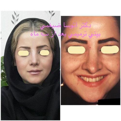 عمل-بینی-178