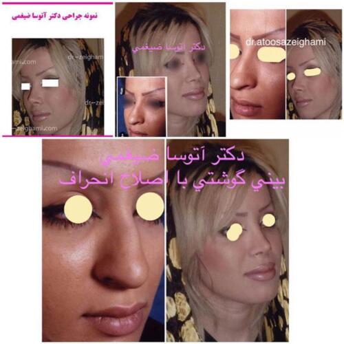 عمل-بینی-180