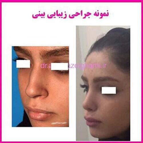 عمل-بینی-182