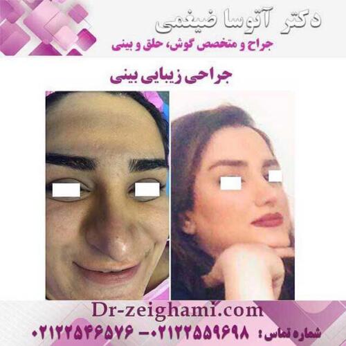 عمل-بینی-183