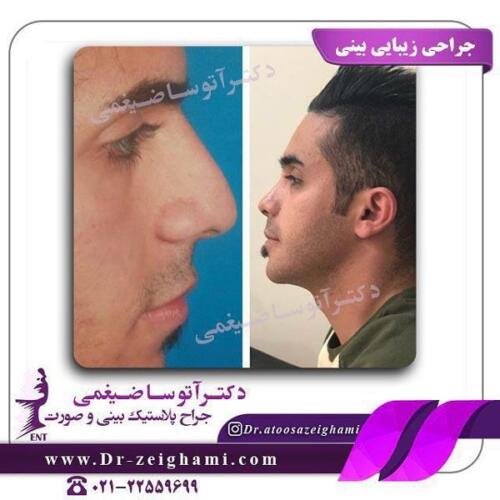 عمل-بینی-194