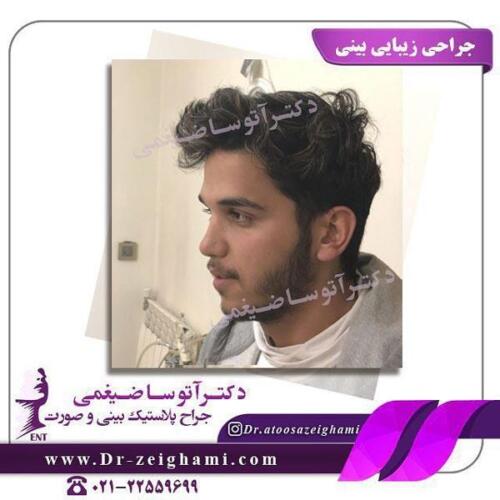 عمل-بینی-195