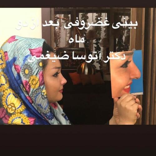 عمل-بینی-199