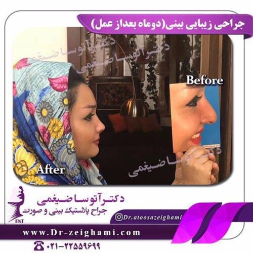 عمل-بینی-202