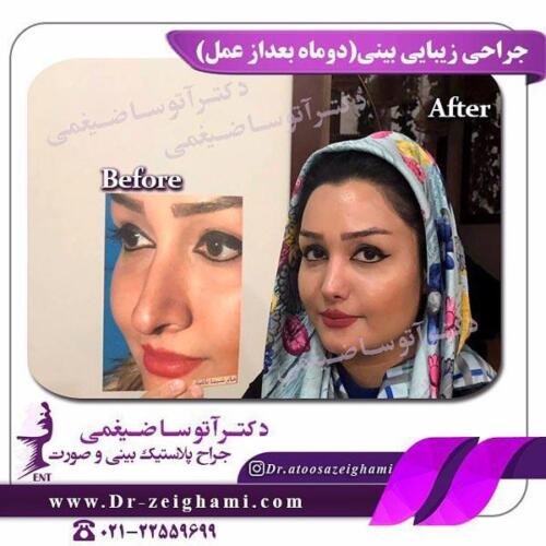 عمل-بینی-203