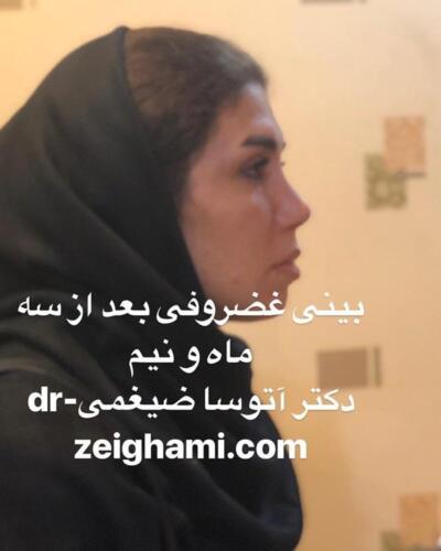 عمل-بینی-207