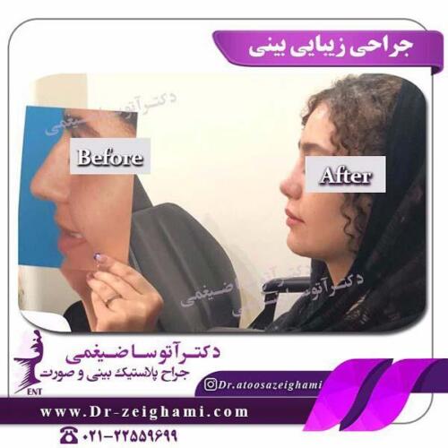 عمل-بینی-210
