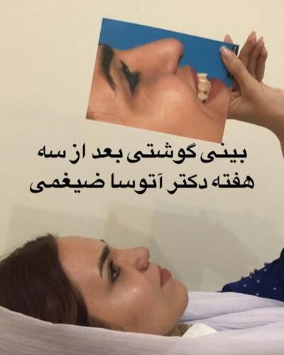 عمل-بینی-211