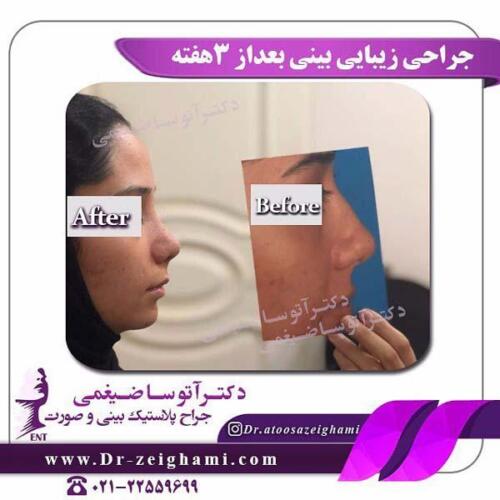 عمل-بینی-212