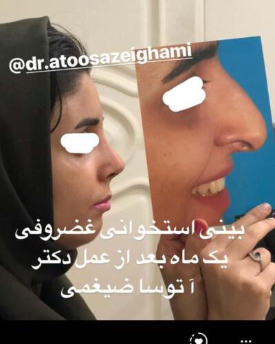 عمل-بینی-215