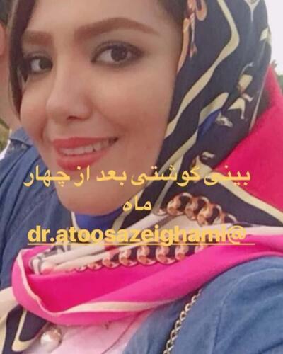 عمل-بینی-216