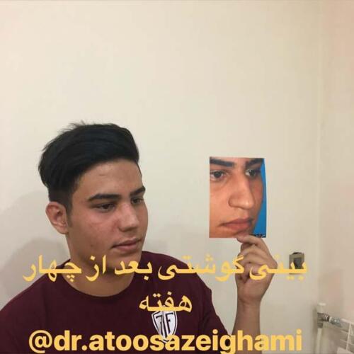 عمل-بینی-217