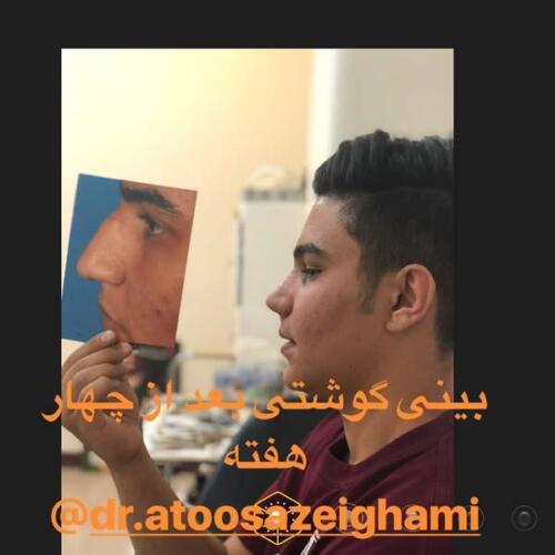 عمل-بینی-218