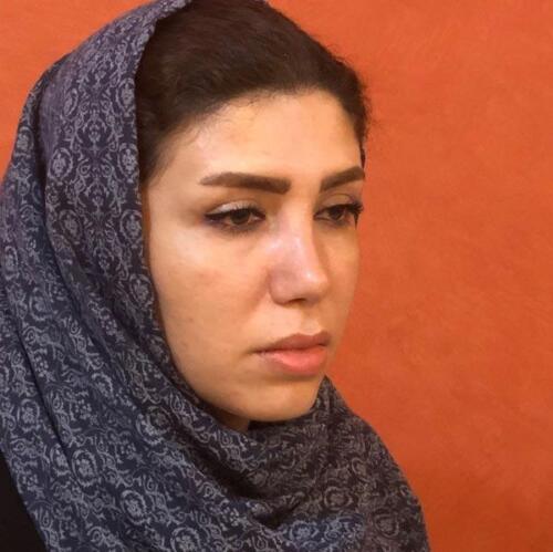 عمل-بینی-220