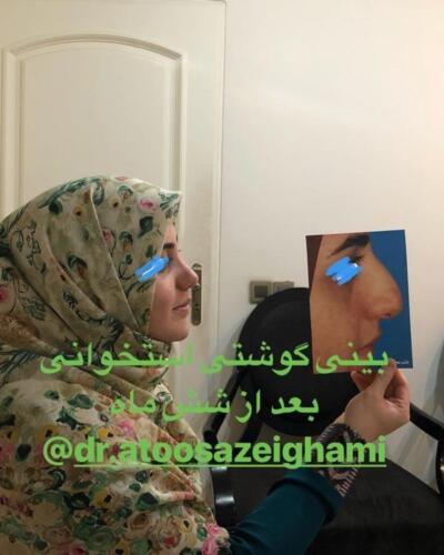 عمل-بینی-236
