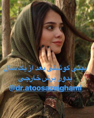 عمل-بینی-242