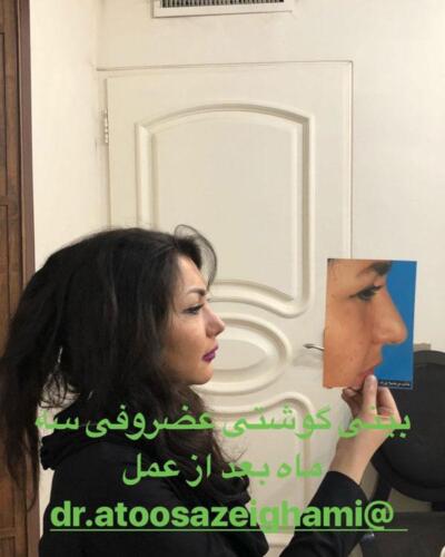 عمل-بینی-246