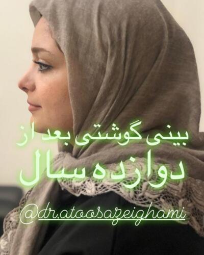 عمل-بینی-283