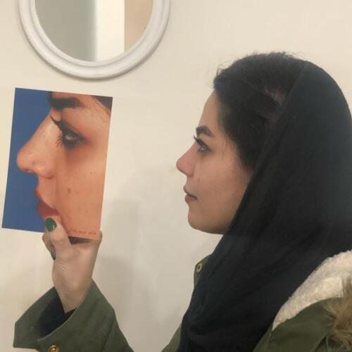 عمل-بینی-288