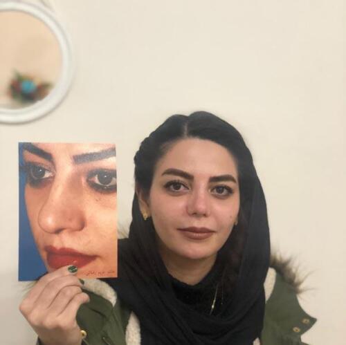 عمل-بینی-290