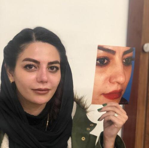 عمل-بینی-292