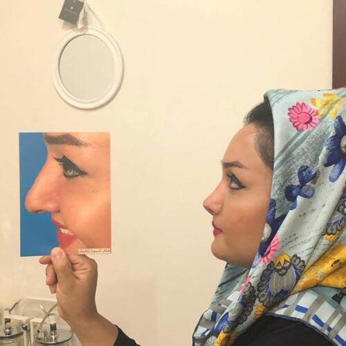 عمل-بینی-305