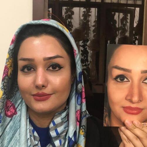 عمل-بینی-306