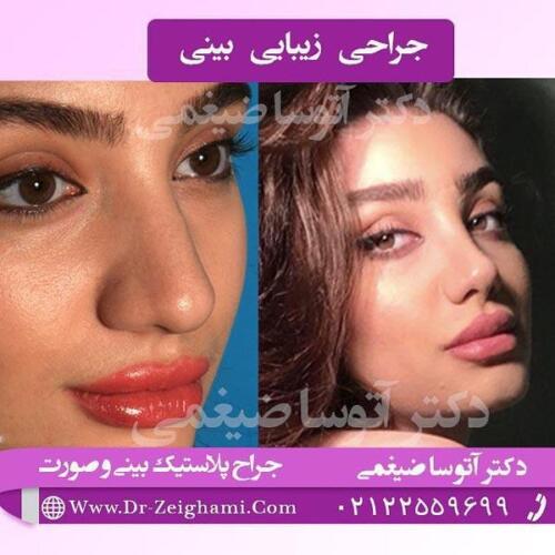 عمل-بینی-307