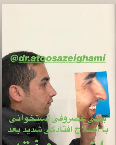 عمل-بینی-308