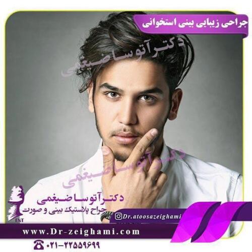 عمل-بینی-311