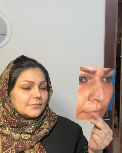 عمل-بینی-339