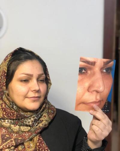 عمل-بینی-341