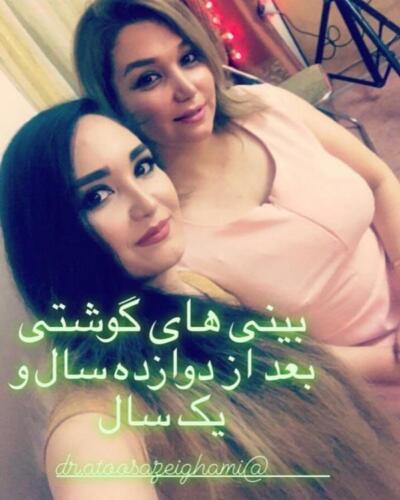 عمل-بینی-359