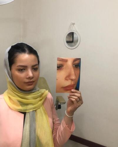 عمل-بینی-385