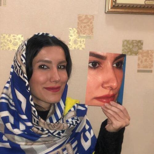 عمل-بینی-391