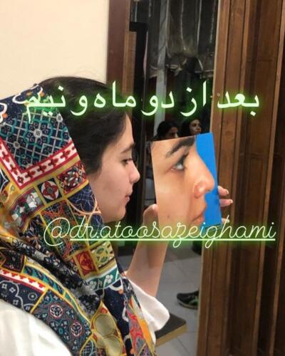 عمل-بینی-412