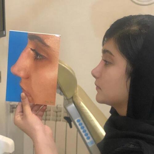 عمل-بینی-420
