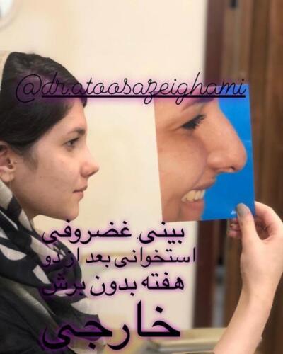 عمل-بینی-422