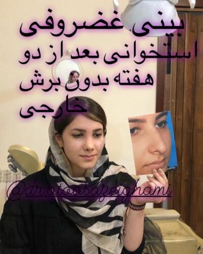 عمل-بینی-423