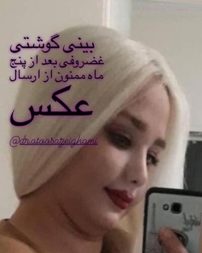 عمل-بینی-425